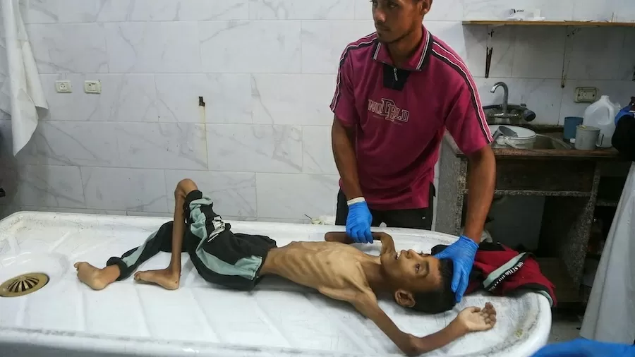 Fome é declarada em Gaza; desnutrição catastrófica atinge 640 mil palestinos